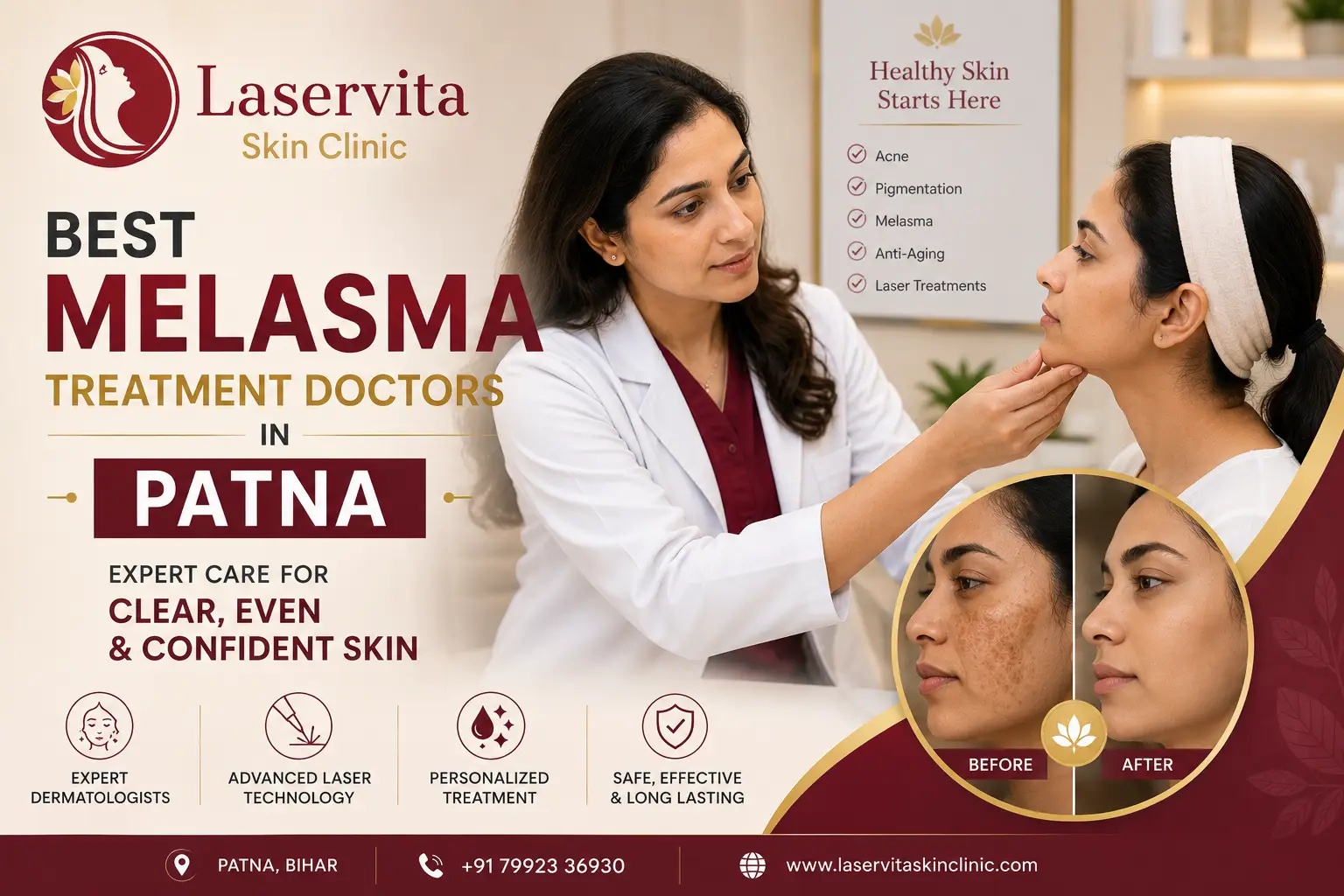 Best Melasma Treatment Doctors in Patna