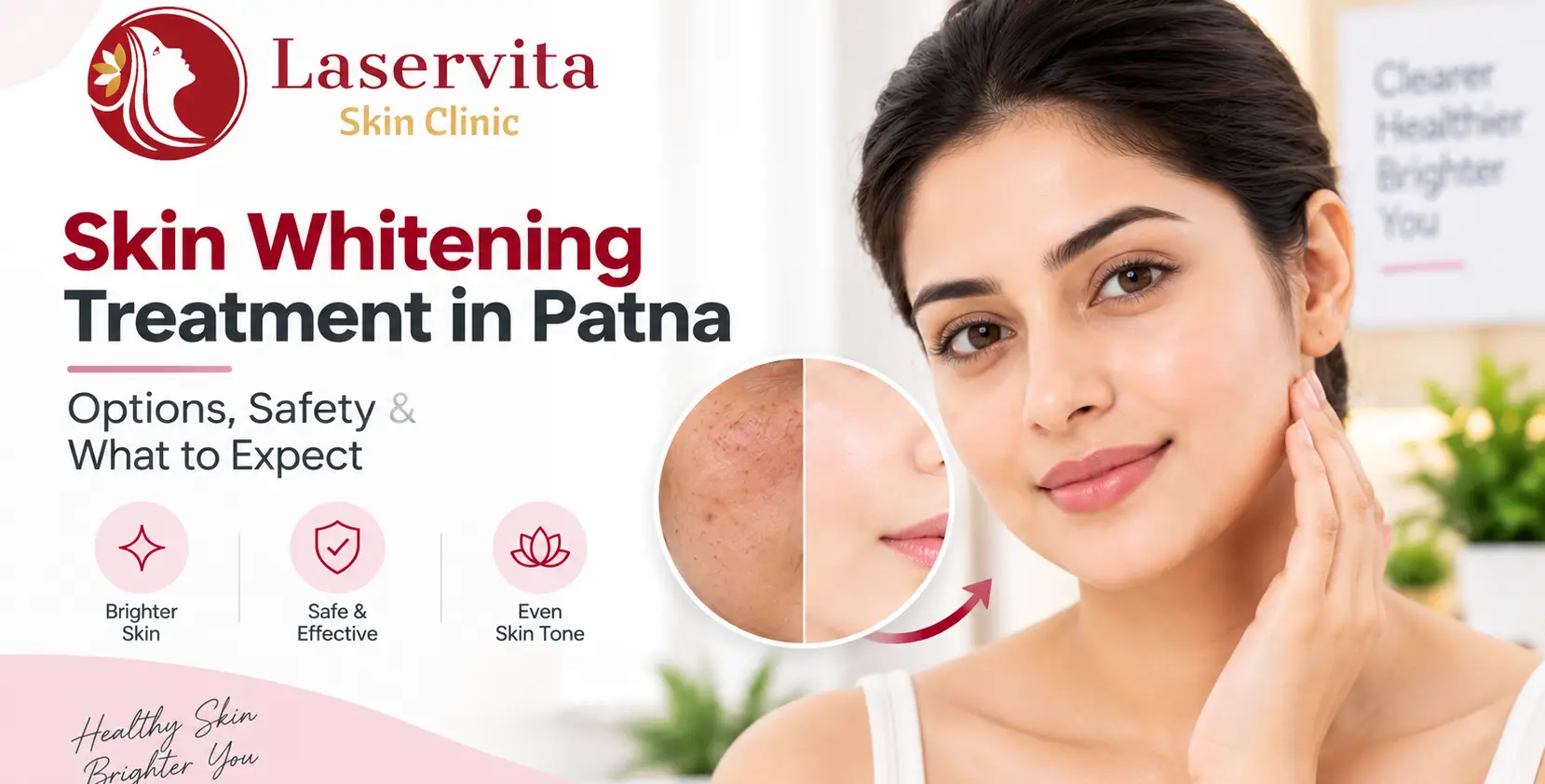 Skin Whitening Treatment in Patna: Options, Safety & What to Expect